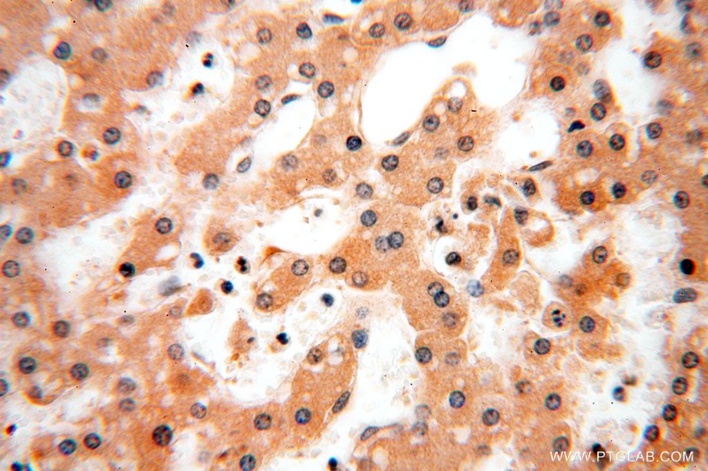 Immunohistochemistry (IHC) staining of human liver tissue using TBC1D23 Polyclonal antibody (17002-1-AP)