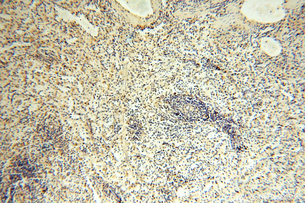 Immunohistochemistry (IHC) staining of human spleen tissue using TBC1D23 Polyclonal antibody (17002-1-AP)