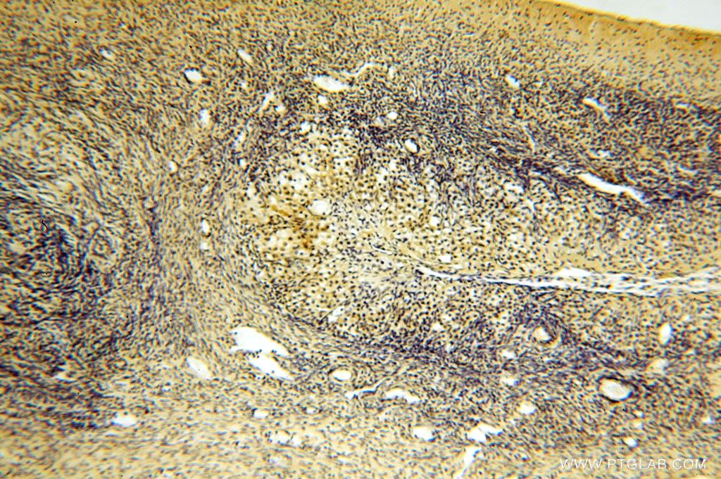 Immunohistochemistry (IHC) staining of human ovary tissue using TBC1D23 Polyclonal antibody (17002-1-AP)