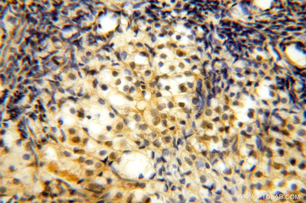 Immunohistochemistry (IHC) staining of human ovary tissue using TBC1D23 Polyclonal antibody (17002-1-AP)