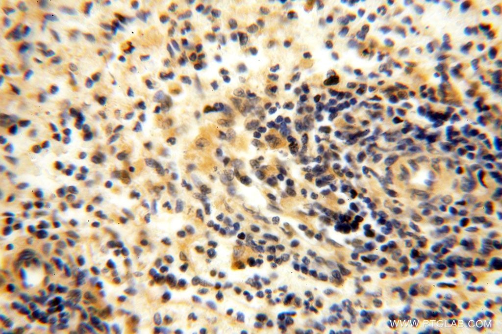 Immunohistochemistry (IHC) staining of human spleen tissue using TBC1D23 Polyclonal antibody (17002-1-AP)