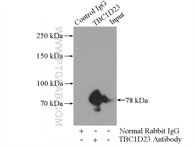 Immunoprecipitation (IP) experiment of HepG2 cells using TBC1D23 Polyclonal antibody (17002-1-AP)