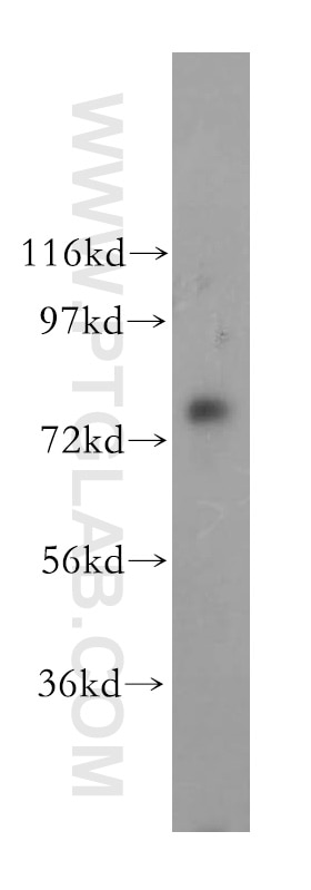 Western Blot (WB) analysis of HepG2 cells using TBC1D23 Polyclonal antibody (17002-1-AP)