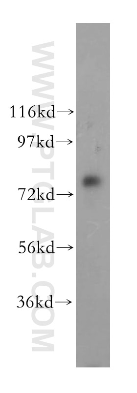 WB analysis of HepG2 using 17002-1-AP