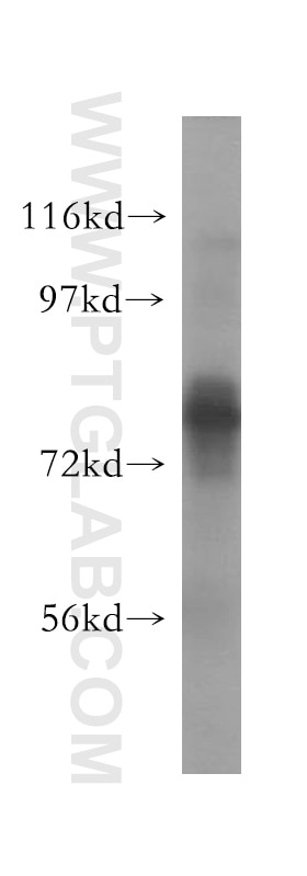 Western Blot (WB) analysis of HeLa cells using TBC1D23 Polyclonal antibody (17002-1-AP)