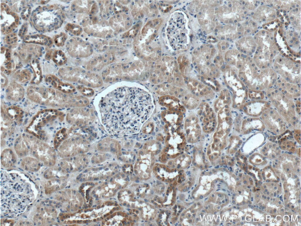 Immunohistochemistry (IHC) staining of human kidney tissue using TBC1D24 Polyclonal antibody (25254-1-AP)