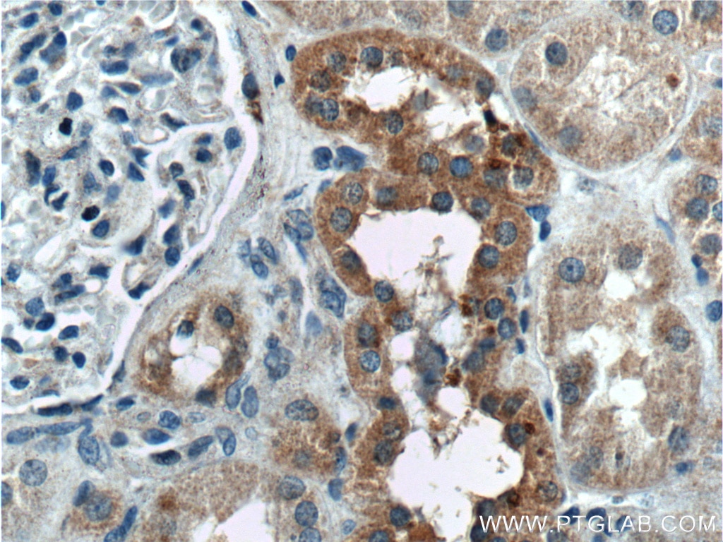 Immunohistochemistry (IHC) staining of human kidney tissue using TBC1D24 Polyclonal antibody (25254-1-AP)