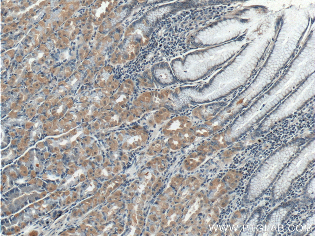 Immunohistochemistry (IHC) staining of human stomach tissue using TBC1D24 Polyclonal antibody (25254-1-AP)