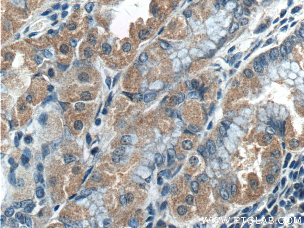 Immunohistochemistry (IHC) staining of human stomach tissue using TBC1D24 Polyclonal antibody (25254-1-AP)