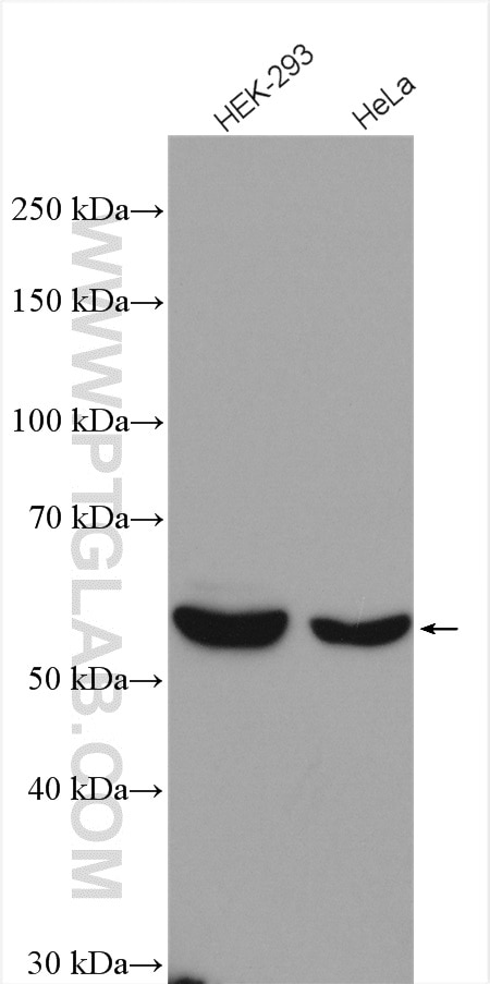 Western Blot (WB) analysis of various lysates using TBC1D24 Polyclonal antibody (25254-1-AP)