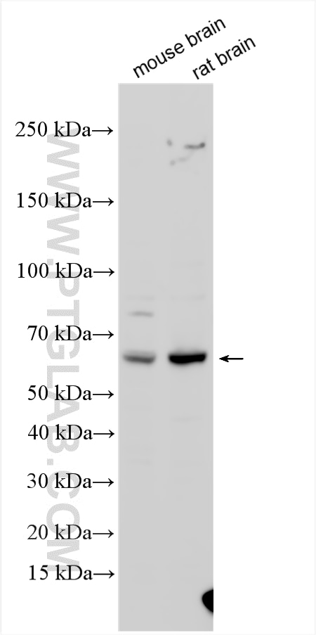 WB analysis using 25254-1-AP Western Blot (WB) analysis of various lysates using TBC1D24 Polyclonal antibody (25254-1-AP)