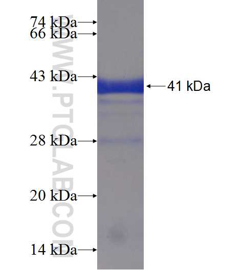 TBC1D24 fusion protein Ag19380 SDS-PAGE