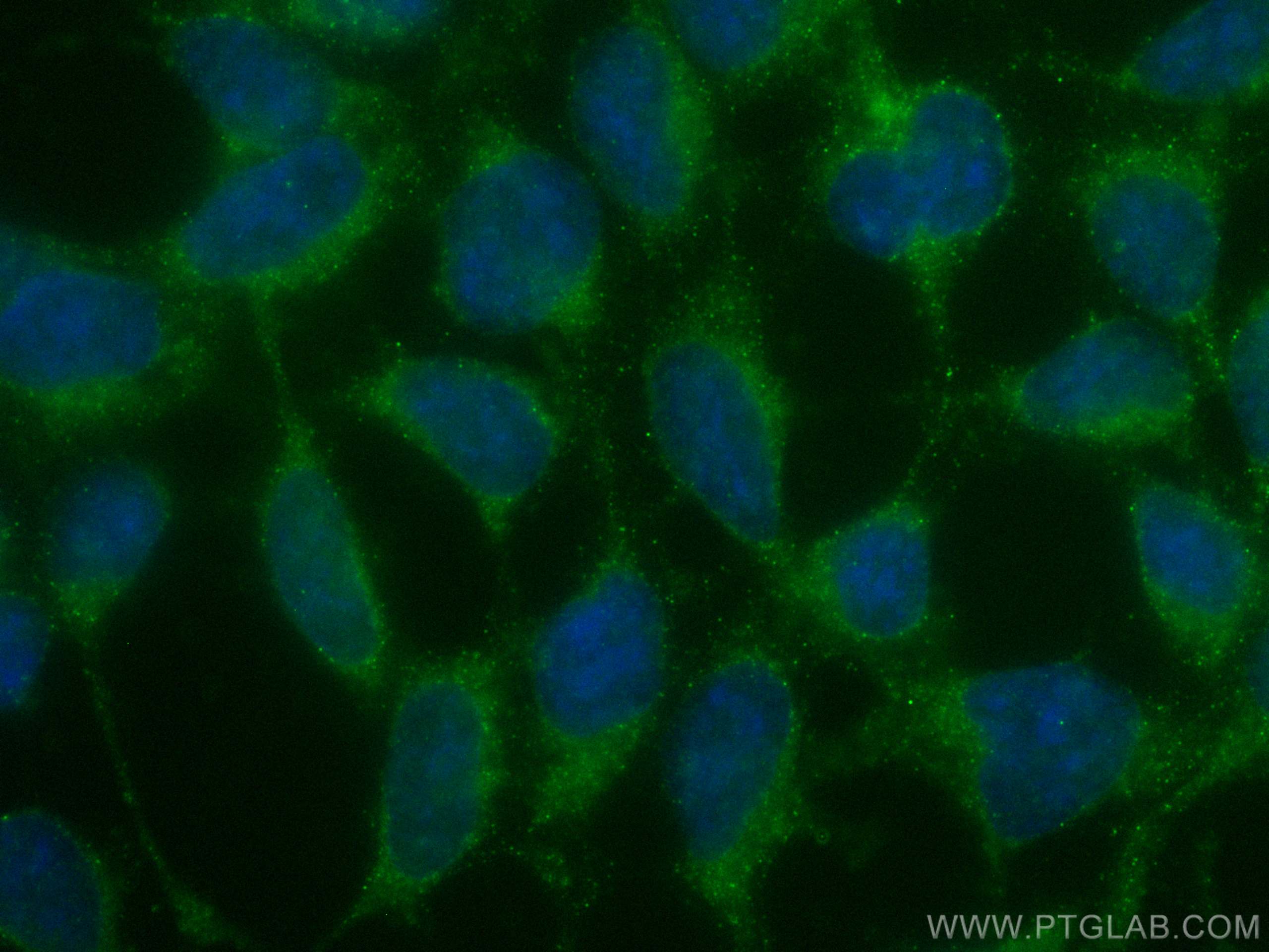 Immunofluorescence (IF) / fluorescent staining of HEK-293 cells using TBC1D25 Monoclonal antibody (67574-1-Ig)