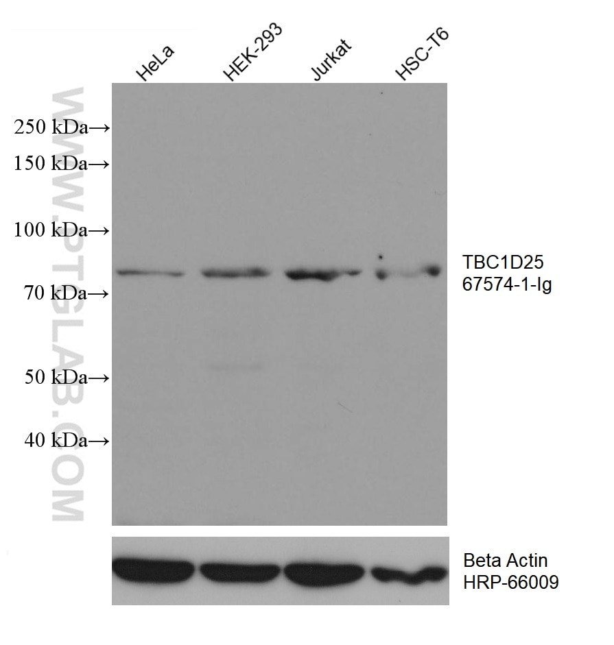 Western Blot (WB) analysis of various lysates using TBC1D25 Monoclonal antibody (67574-1-Ig)