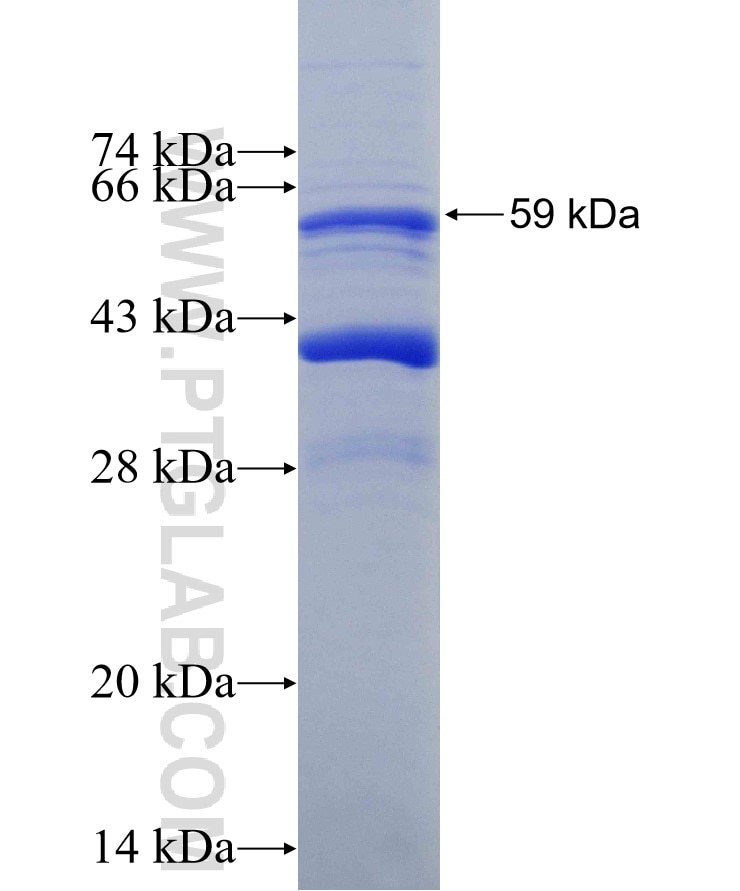 TBC1D25 fusion protein Ag29465 SDS-PAGE TBC1D25 fusion protein Ag29465 SDS-PAGE