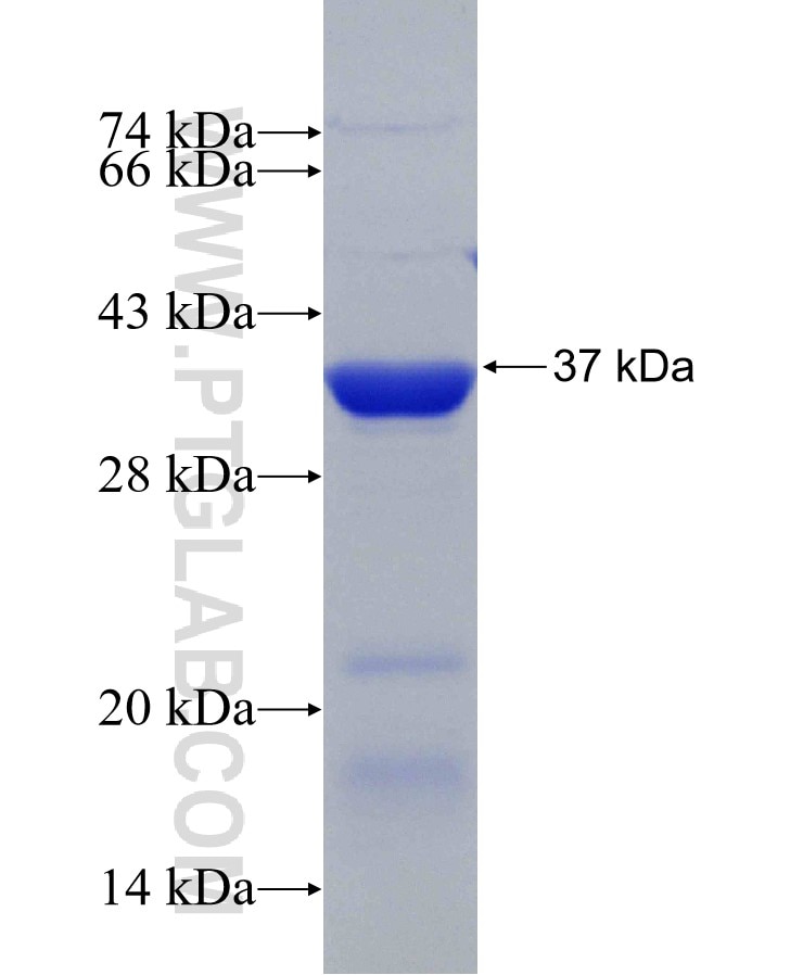 TBC1D25 fusion protein Ag29470 SDS-PAGE
