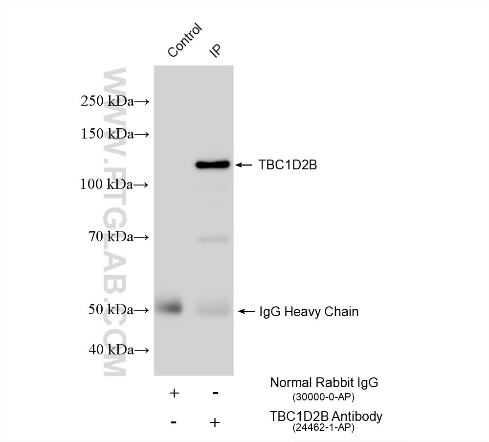Immunoprecipitation (IP) experiment of BxPC-3 cells using TBC1D2B Polyclonal antibody (24462-1-AP)