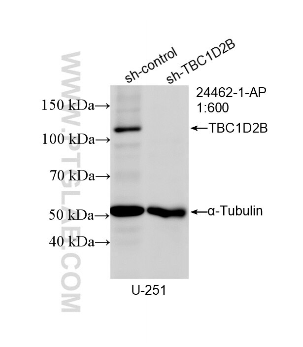 Western Blot (WB) analysis of U-251 cells using TBC1D2B Polyclonal antibody (24462-1-AP)