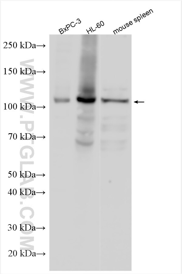 Western Blot (WB) analysis of various lysates using TBC1D2B Polyclonal antibody (24462-1-AP)