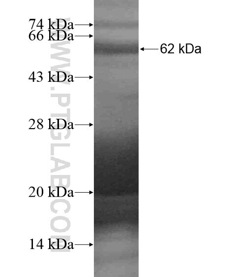 TBC1D2B fusion protein Ag19632 SDS-PAGE