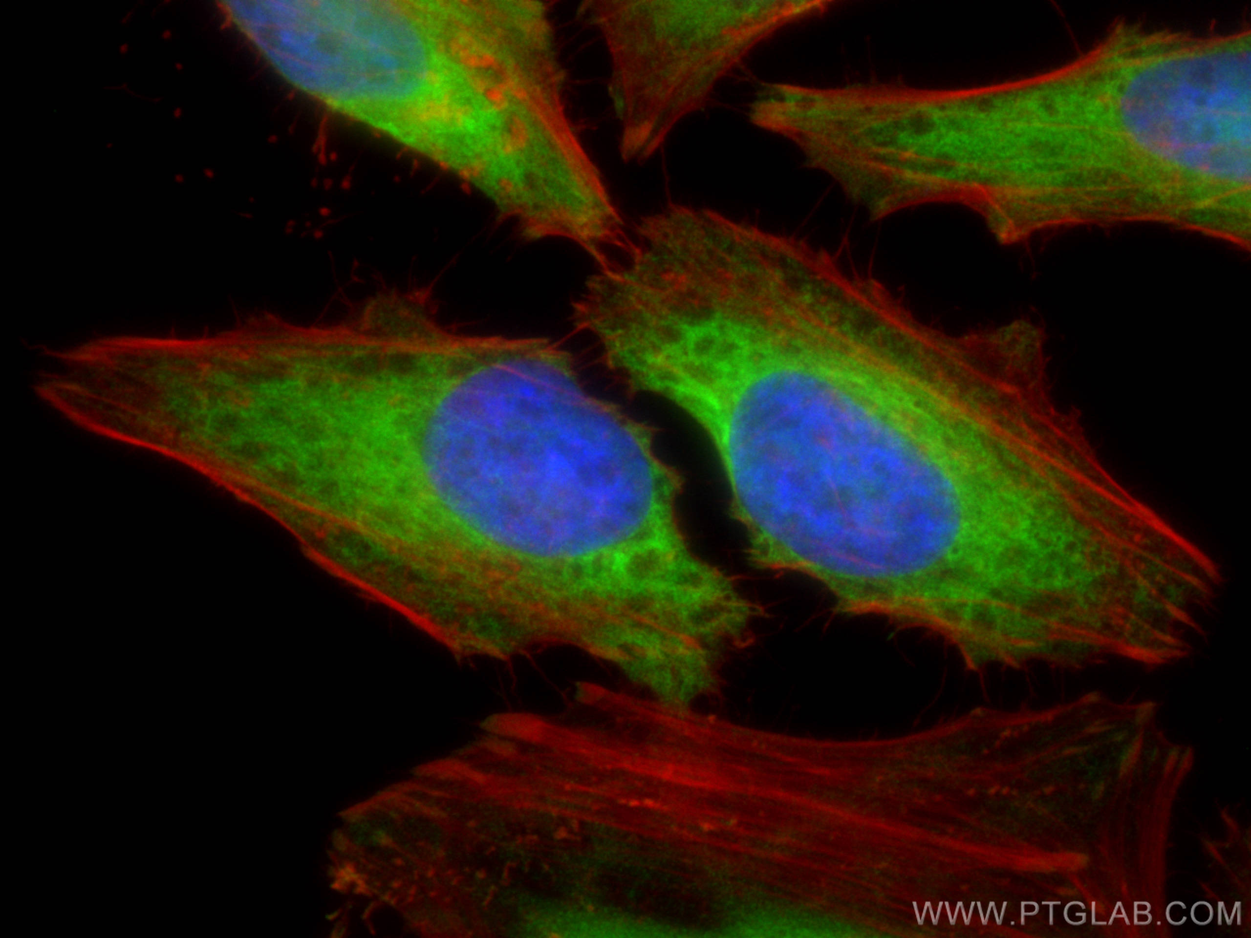 Immunofluorescence (IF) / fluorescent staining of HeLa cells using TBC1D4 Polyclonal antibody (20024-1-AP)
