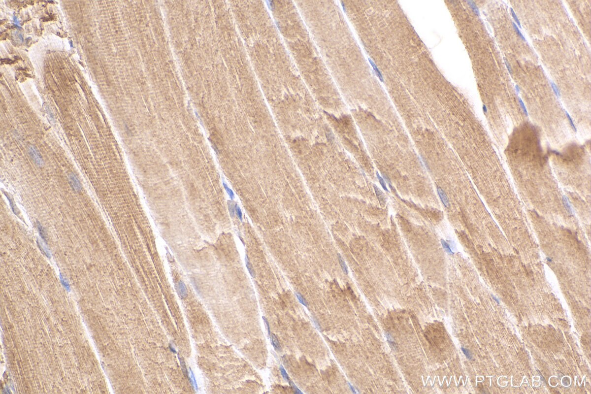 Immunohistochemistry (IHC) staining of rat skeletal muscle tissue using TBC1D4 Polyclonal antibody (20024-1-AP)