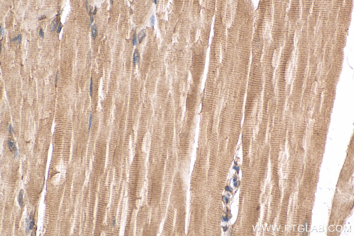 Immunohistochemistry (IHC) staining of mouse skeletal muscle tissue using TBC1D4 Polyclonal antibody (20024-1-AP)