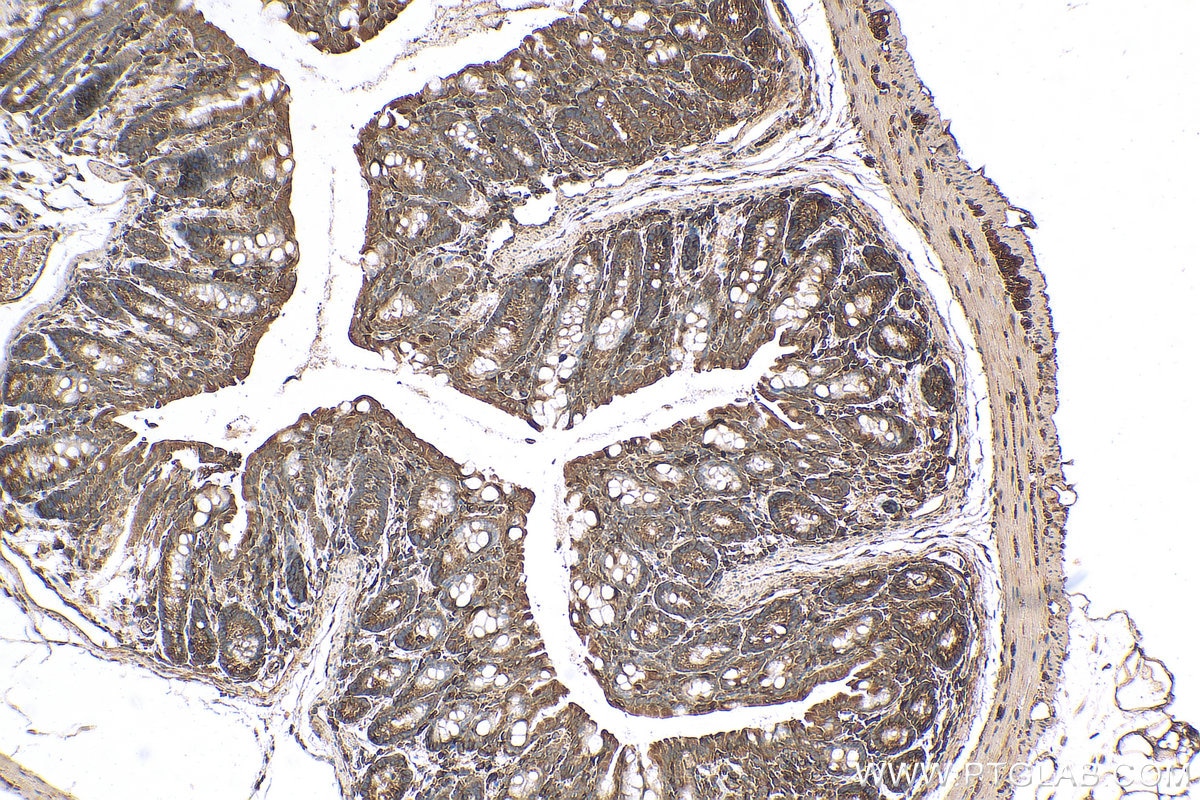 Immunohistochemistry (IHC) staining of mouse colon tissue using TBC1D4 Polyclonal antibody (20024-1-AP)