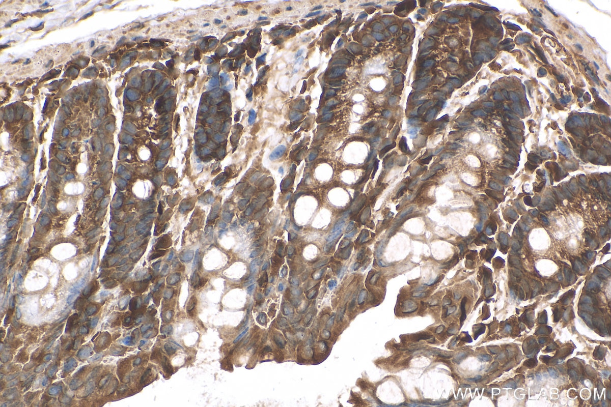 Immunohistochemistry (IHC) staining of mouse colon tissue using TBC1D4 Polyclonal antibody (20024-1-AP)