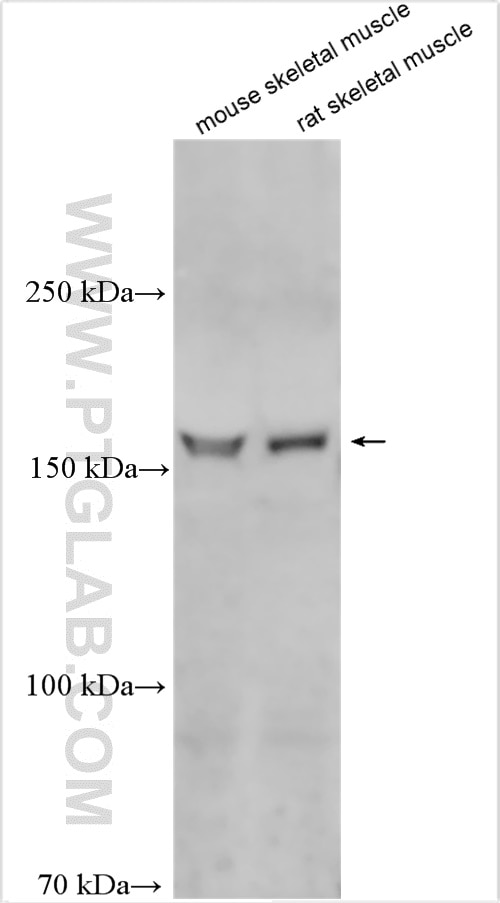 Western Blot (WB) analysis of various lysates using TBC1D4 Polyclonal antibody (20024-1-AP)