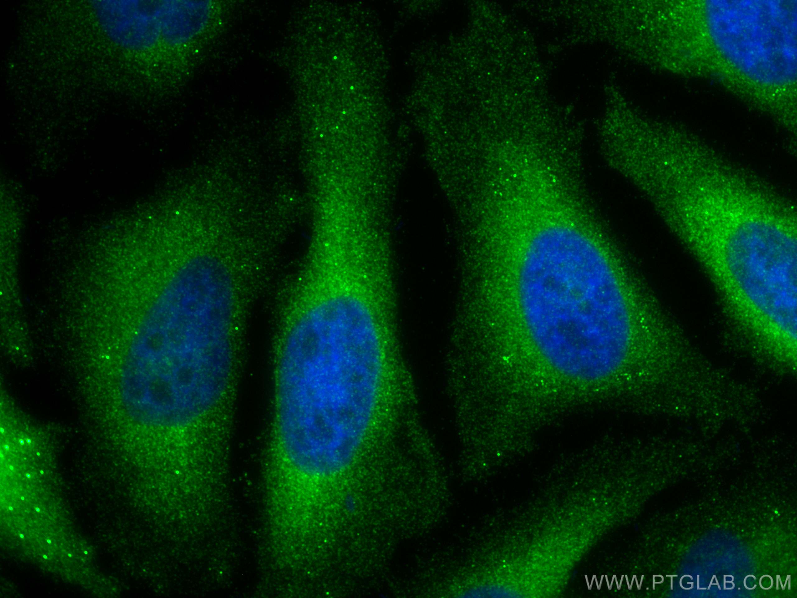 Immunofluorescence (IF) / fluorescent staining of HeLa cells using TBC1D4 Polyclonal antibody (24667-1-AP)