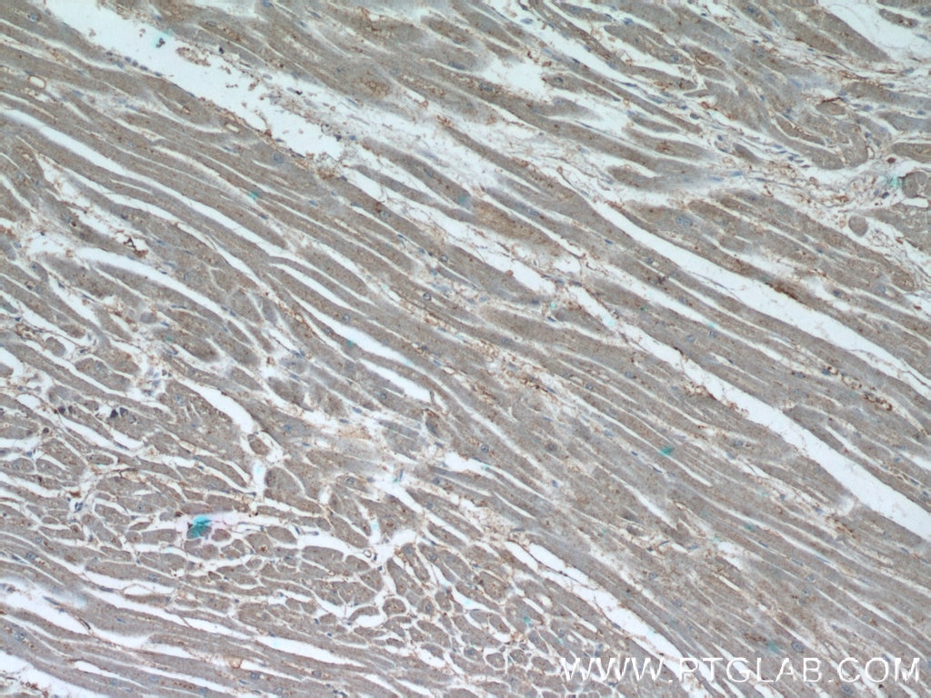 Immunohistochemistry (IHC) staining of human heart tissue using TBC1D4 Polyclonal antibody (24667-1-AP)