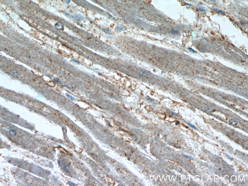 IHC staining of human heart using 24667-1-AP