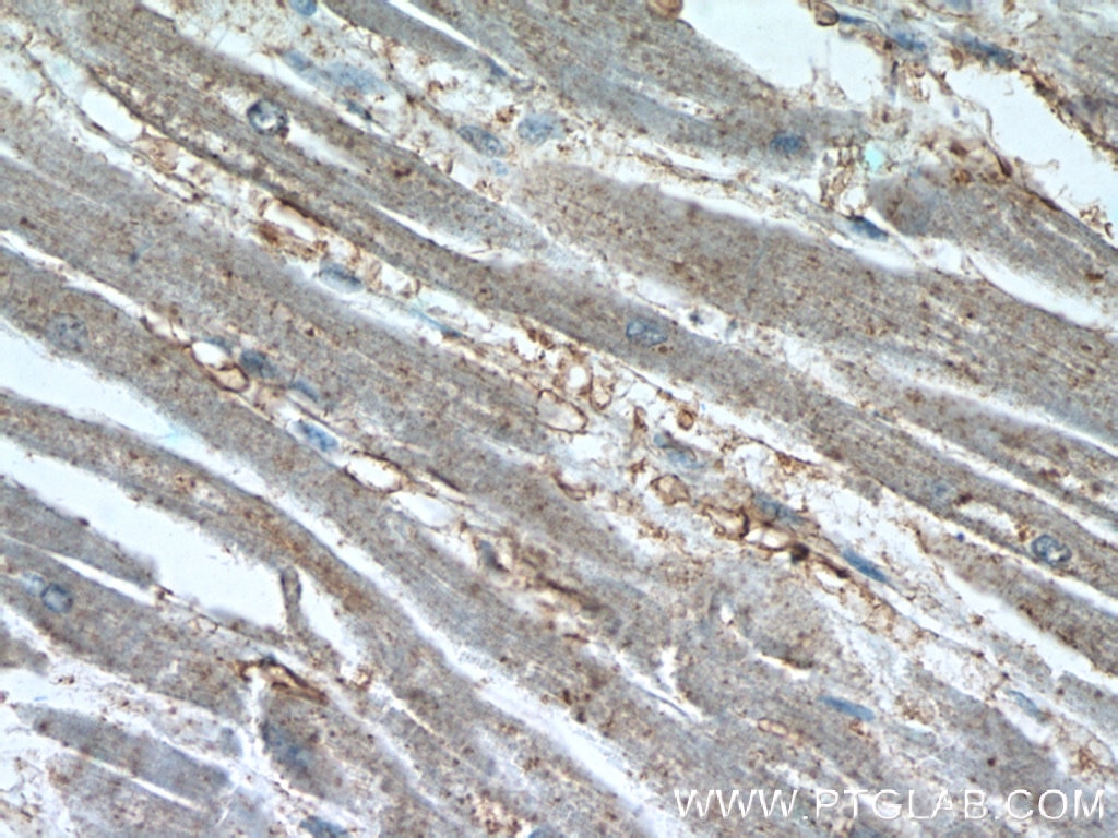 Immunohistochemistry (IHC) staining of human heart tissue using TBC1D4 Polyclonal antibody (24667-1-AP)