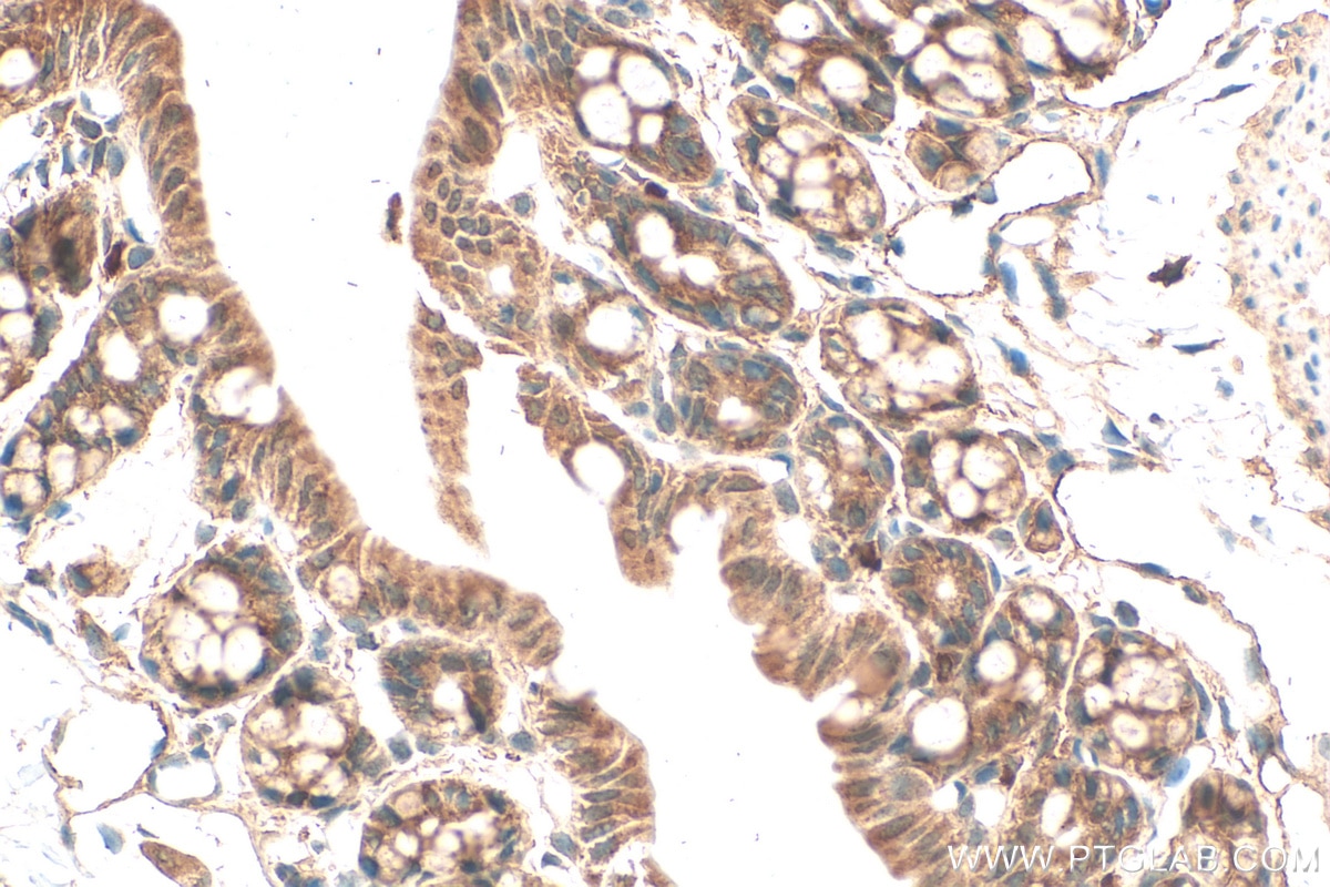 Immunohistochemistry (IHC) staining of mouse colon tissue using TBC1D4 Polyclonal antibody (24667-1-AP)