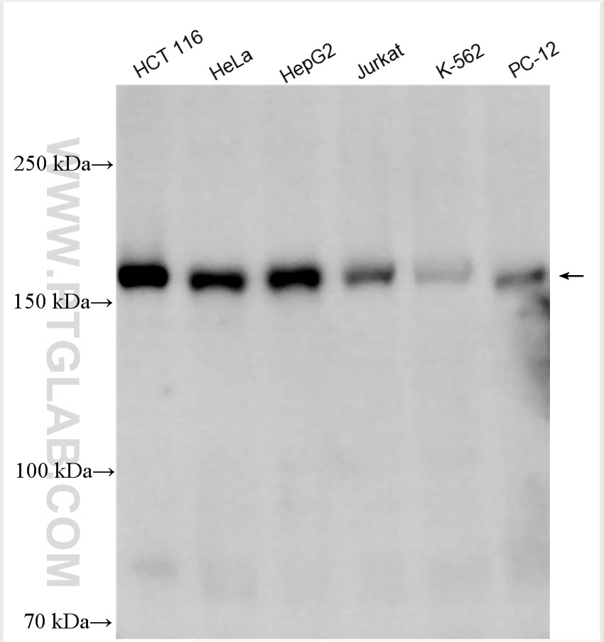 Western Blot (WB) analysis of various lysates using TBC1D4 Polyclonal antibody (24667-1-AP)