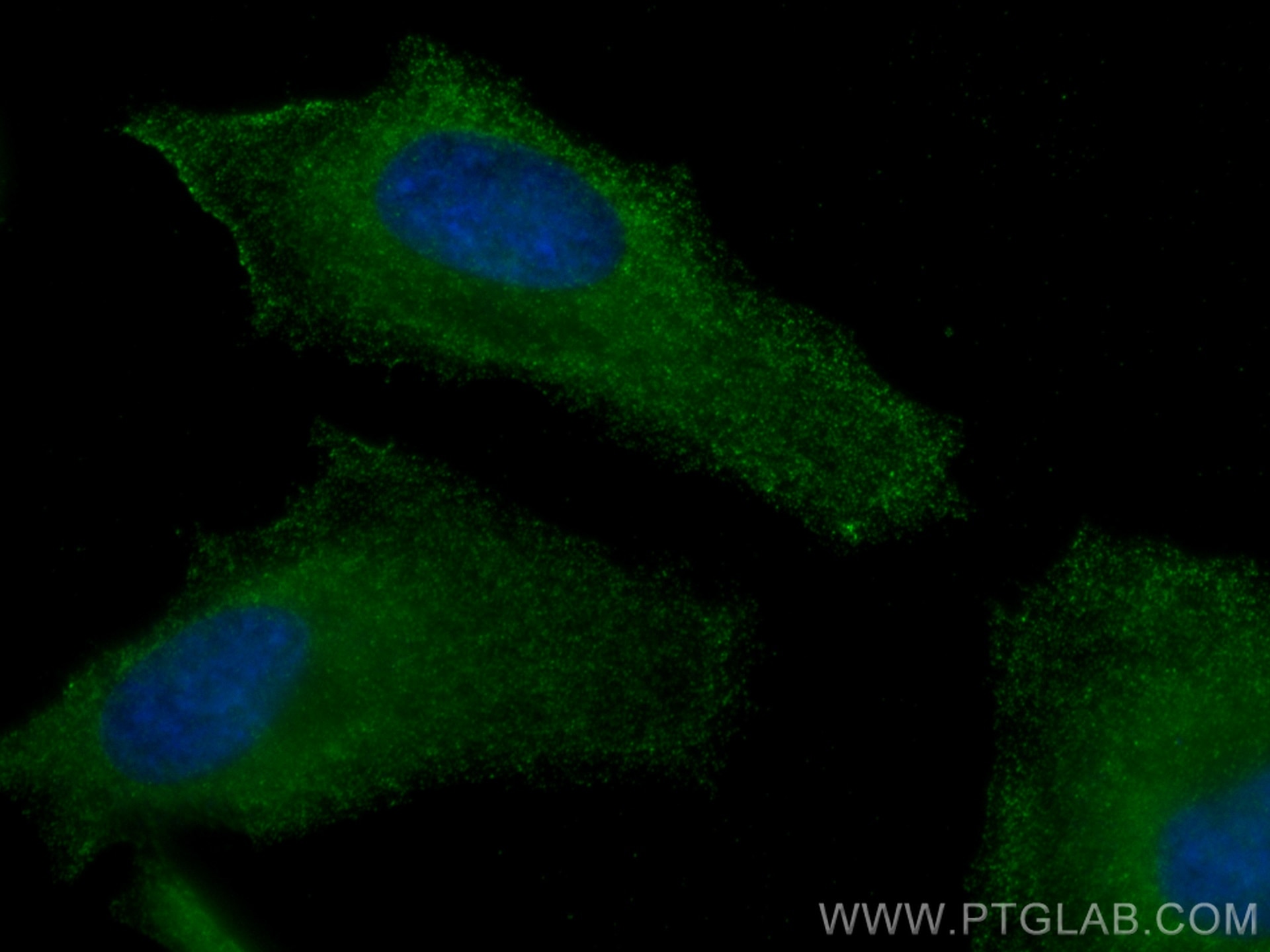 Immunofluorescence (IF) / fluorescent staining of HeLa cells using CoraLite® Plus 488-conjugated TBC1D4 Monoclonal an (CL488-68063)