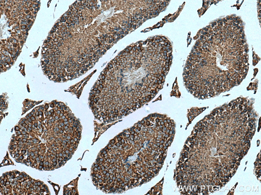 Immunohistochemistry (IHC) staining of mouse testis tissue using TBC1D5 Polyclonal antibody (17078-1-AP)