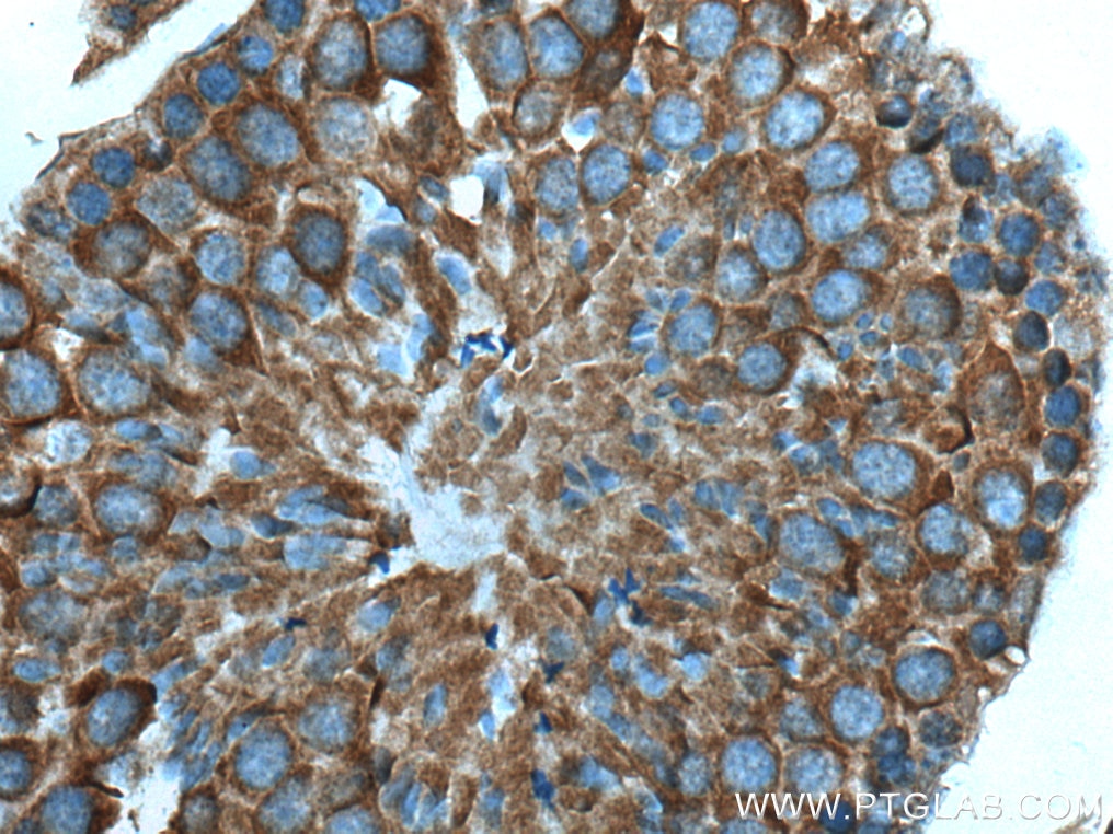 Immunohistochemistry (IHC) staining of mouse testis tissue using TBC1D5 Polyclonal antibody (17078-1-AP)
