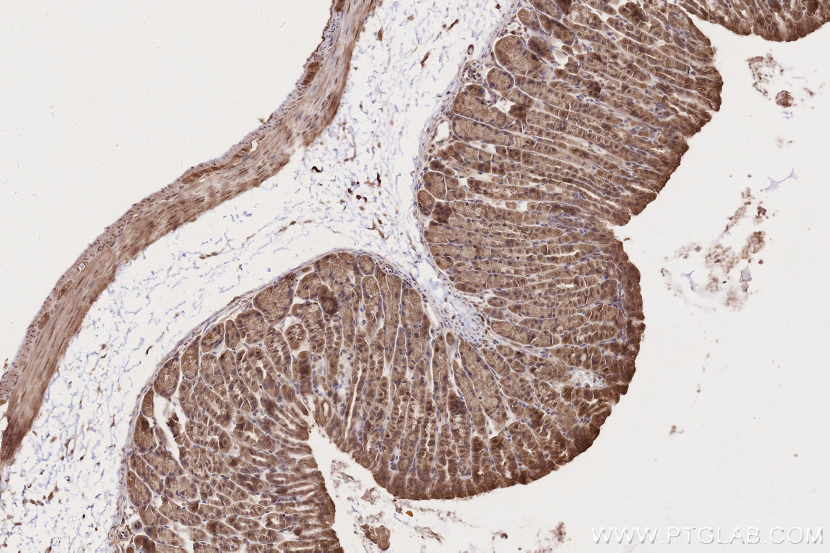 Immunohistochemistry (IHC) staining of mouse stomach tissue using TBC1D5 Polyclonal antibody (17078-1-AP)