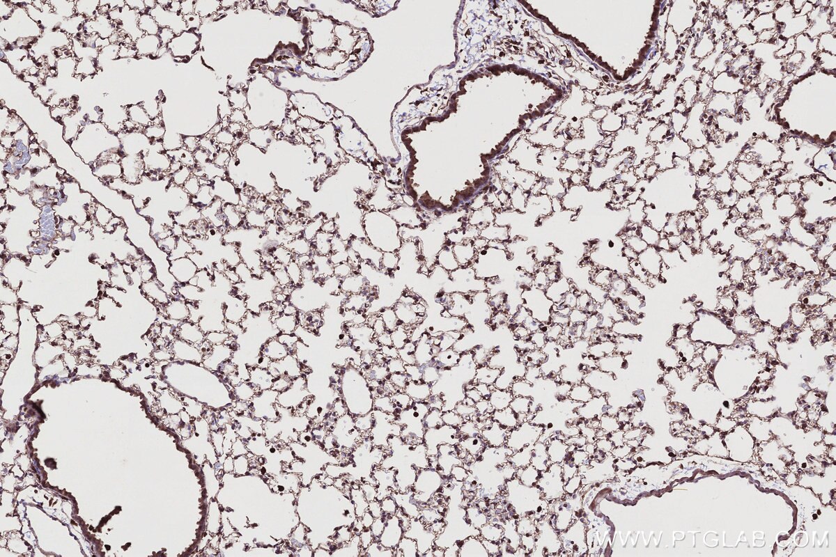 Immunohistochemistry (IHC) staining of mouse lung tissue using TBC1D5 Polyclonal antibody (17078-1-AP)
