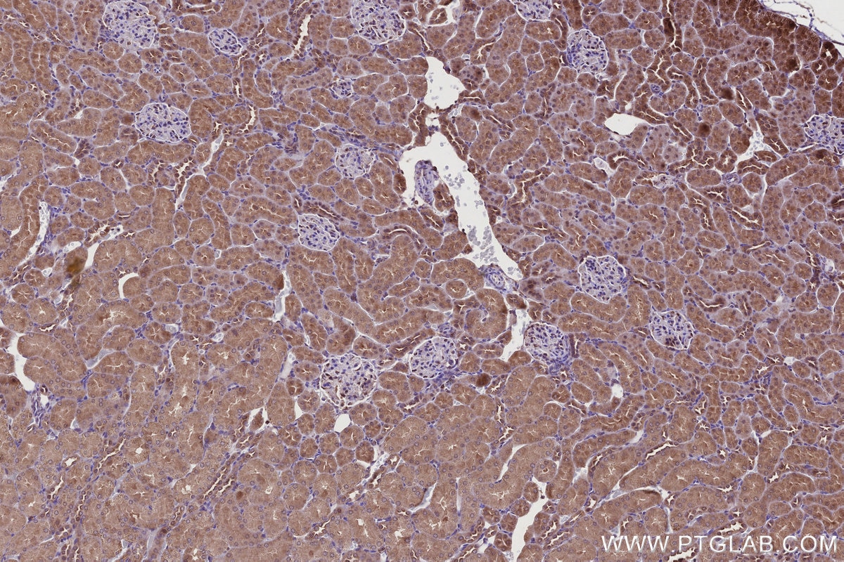 Immunohistochemistry (IHC) staining of rat kidney tissue using TBC1D5 Polyclonal antibody (17078-1-AP)
