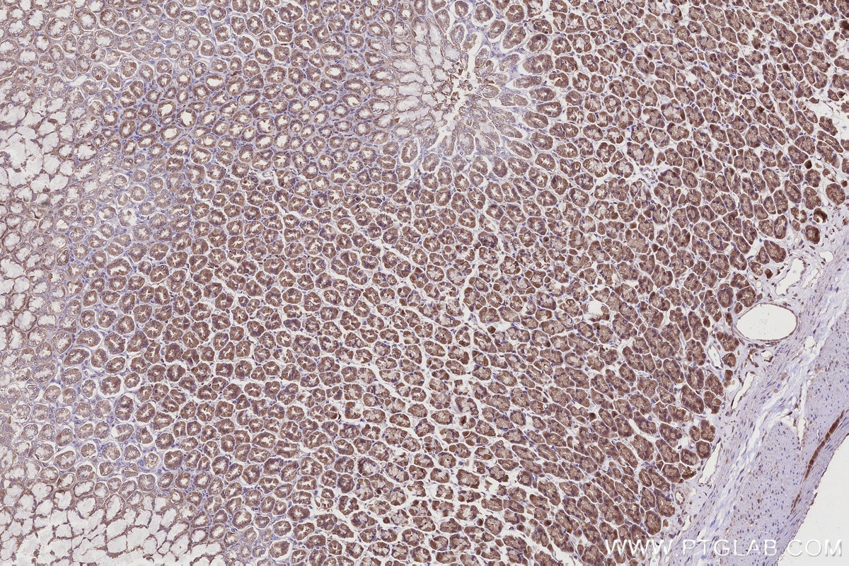 Immunohistochemistry (IHC) staining of rat stomach tissue using TBC1D5 Polyclonal antibody (17078-1-AP)