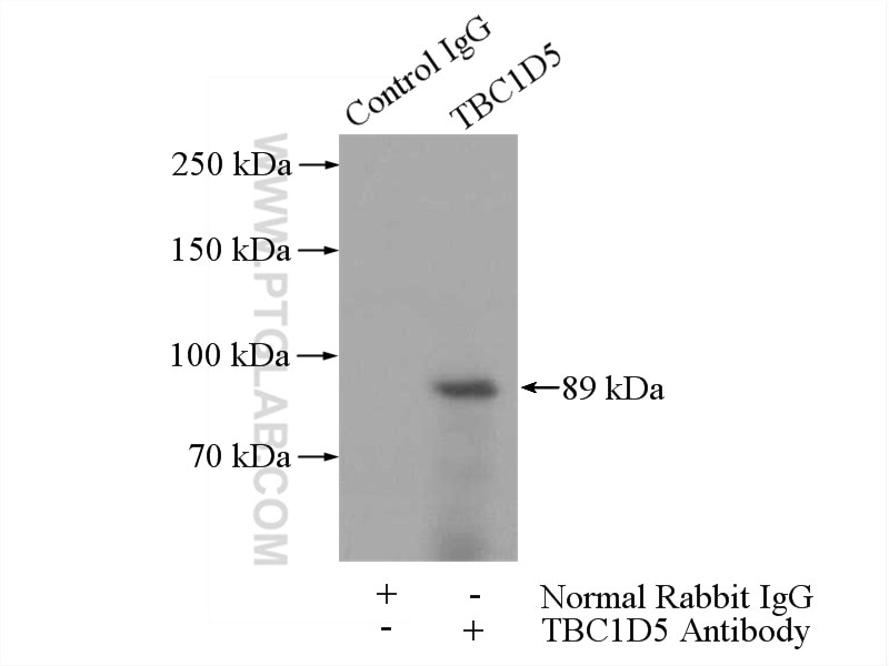 Immunoprecipitation (IP) experiment of A431 cells using TBC1D5 Polyclonal antibody (17078-1-AP)