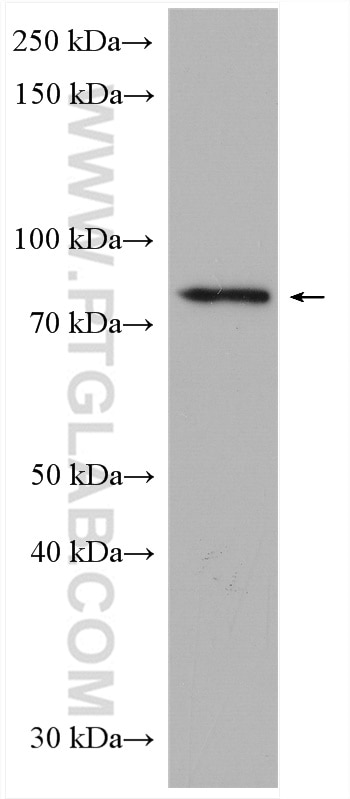 Western Blot (WB) analysis of 3T3-L1 cells using TBC1D5 Polyclonal antibody (17078-1-AP)