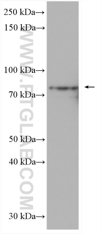 Western Blot (WB) analysis of U-251 cells using TBC1D5 Polyclonal antibody (17078-1-AP)
