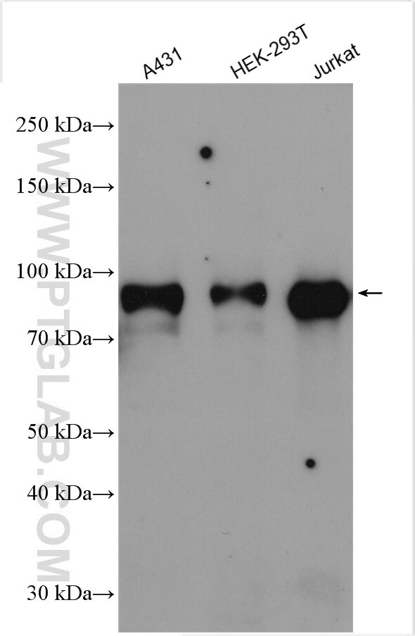 Western Blot (WB) analysis of various lysates using TBC1D5 Polyclonal antibody (17078-1-AP)