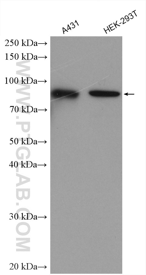 Western Blot (WB) analysis of various lysates using TBC1D5 Polyclonal antibody (17078-1-AP)