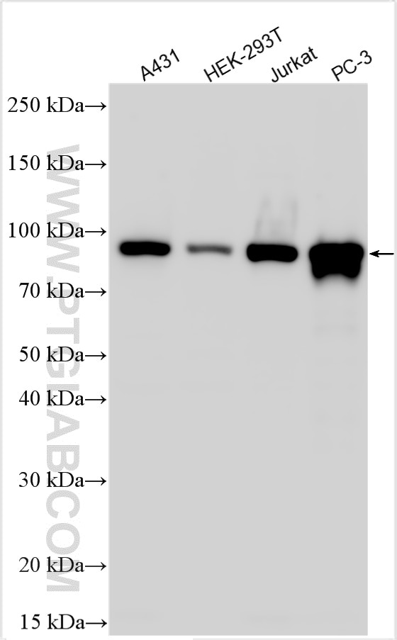 Western Blot (WB) analysis of various lysates using TBC1D5 Polyclonal antibody (17078-1-AP)