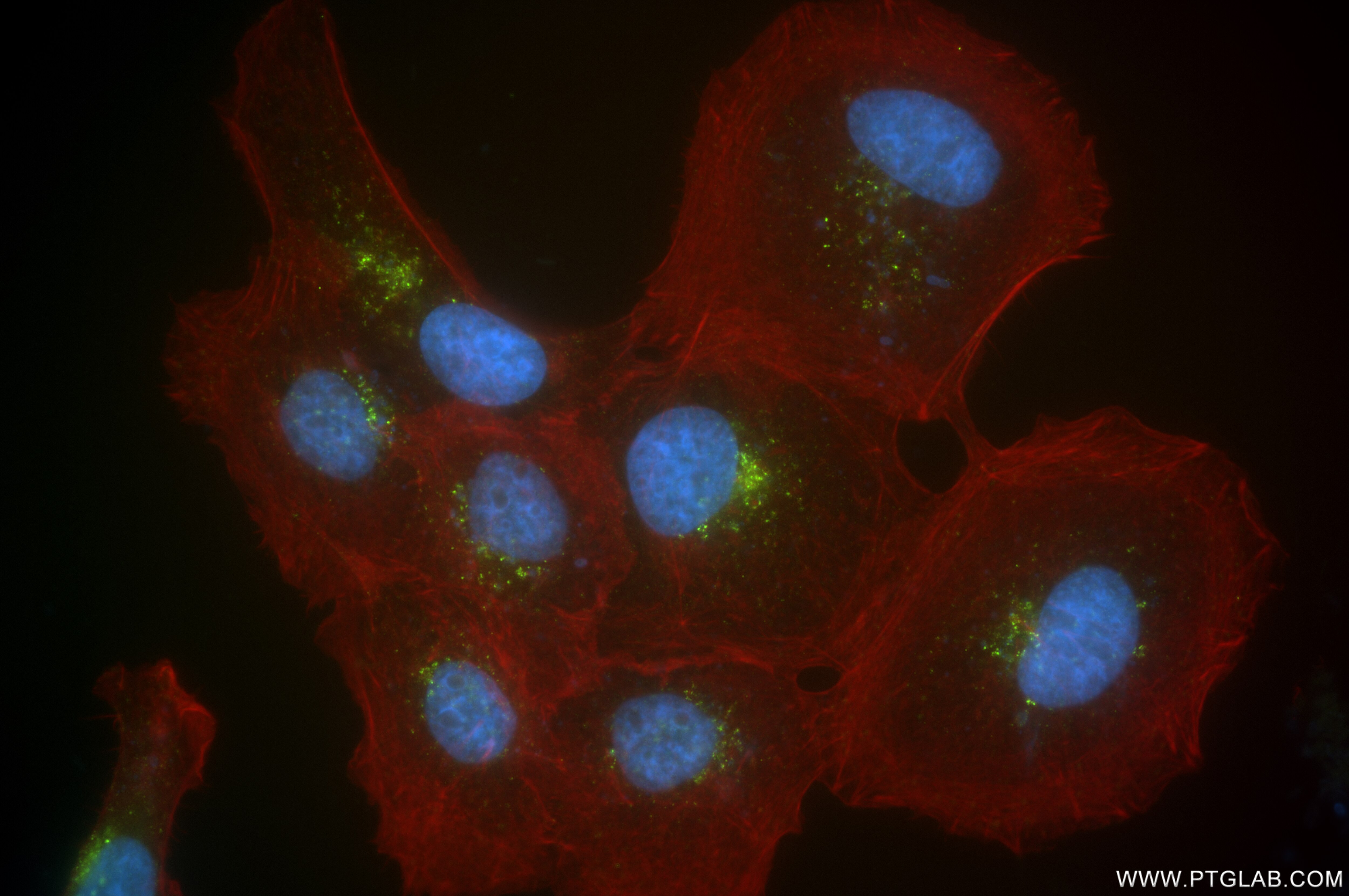 Immunofluorescence (IF) / fluorescent staining of A431 cells using TBC1D5 Recombinant antibody (84990-4-RR)